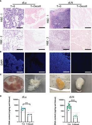 Modelling metastatic colonization of cholangiocarcinoma organoids in decellularized lung and lymph nodes